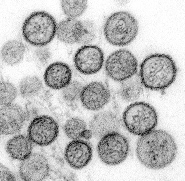 Transmission electron micrograph of Sin Nombre virus. Credit: Public Domain via CDC
